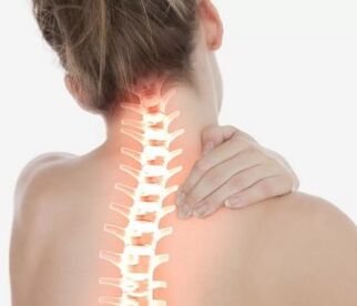 Osteochondroza szyjka macicy