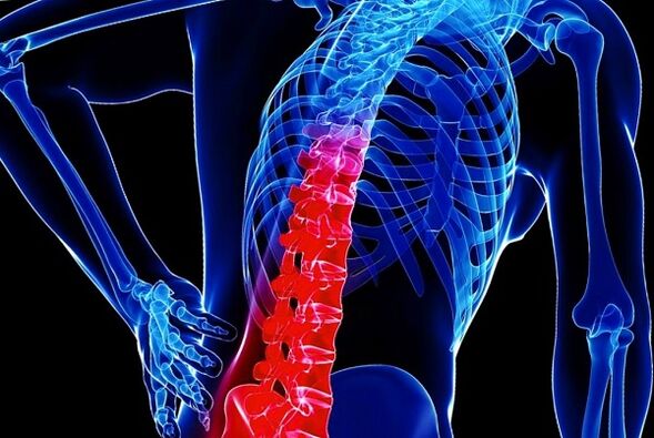 Przyczyny rozwoju osteochondrozy klatki piersiowej