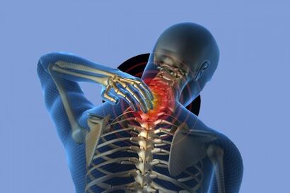 ból szyi z osteochondrozą